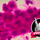 Illustration for article titled Fuck You, Cancer
